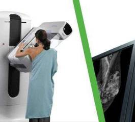 Mamografia Digital e Convencional, Entenda as Diferenças