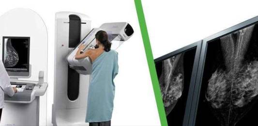 Mamografia Digital e Convencional, Entenda as Diferenças