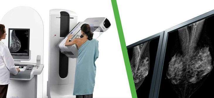Como funciona a mamografia