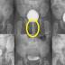 Uretrocistografia Miccional, Conheça as Aplicações do Exame