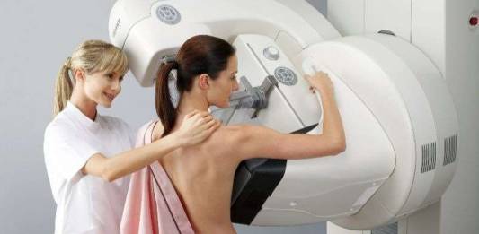 Mamografia, Dúvidas Mais Comuns