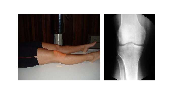 posicionamento radiológico joelho