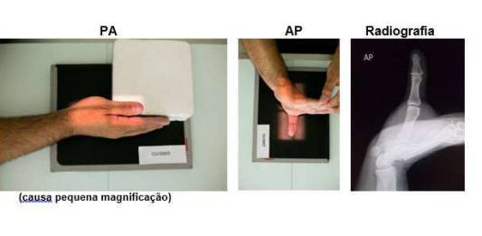 Posicionamento Radiológico do Primeiro Dedo da Mão (Polegar)