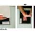 Posicionamento Radiológico do Primeiro Dedo da Mão (Polegar)
