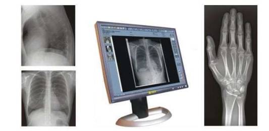 Os 4 Fatores de Qualidade da Imagem Radiográfica, Saiba Mais