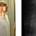 Radiografia da Hipofaringe, Saiba Tudo Sobre o Exame