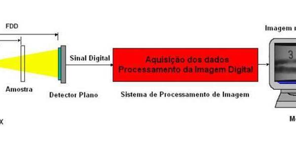 Arquivos Radiologia Industrial - Blog De Radiologia