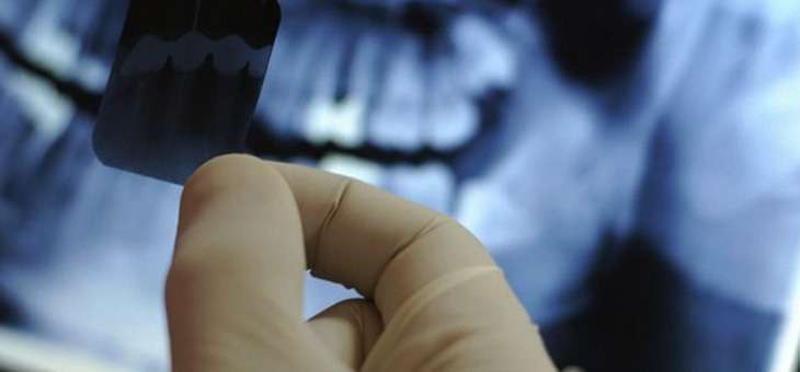 radiologia odontológica