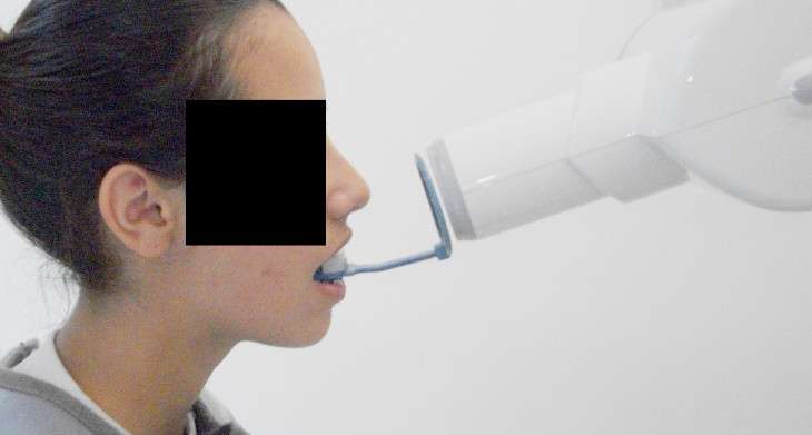 radiologia odontológica periapical