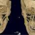 03 Reconstruções de Tomografia 3D do Crânio Incríveis