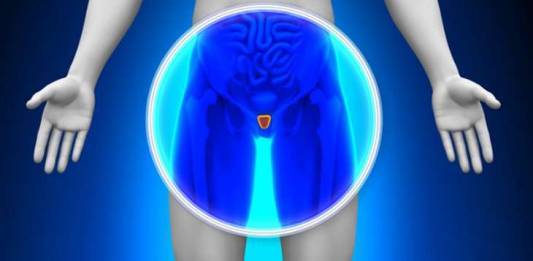 A Radioterapia guiada por imagem no tratamento do câncer de próstata