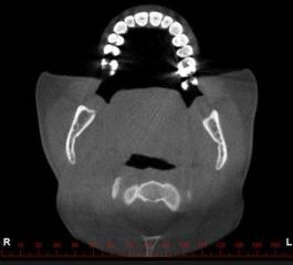 A Importância da Tomografia Cone Beam na Radiologia Odontológica